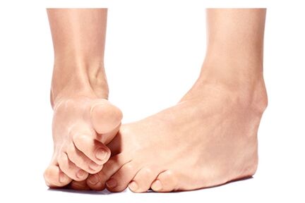 Foot Trooper – natural remedy for foot and nail fungus